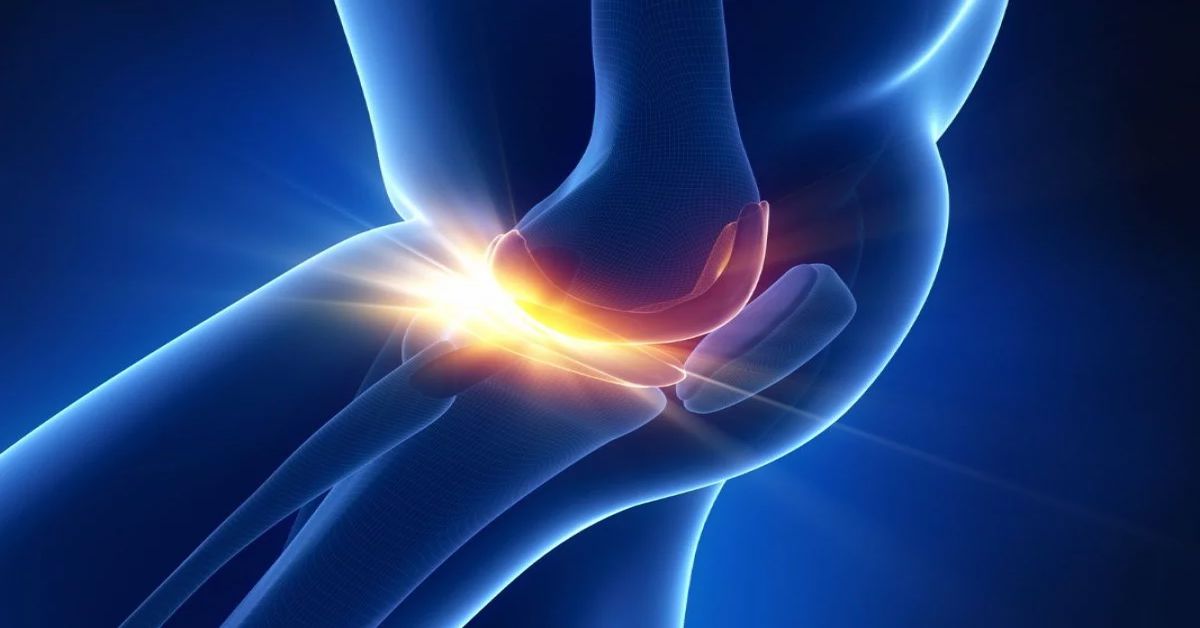 Diz Kapağı Çıkığı Tedavisi Diz kapağı çıkığı tedavisi